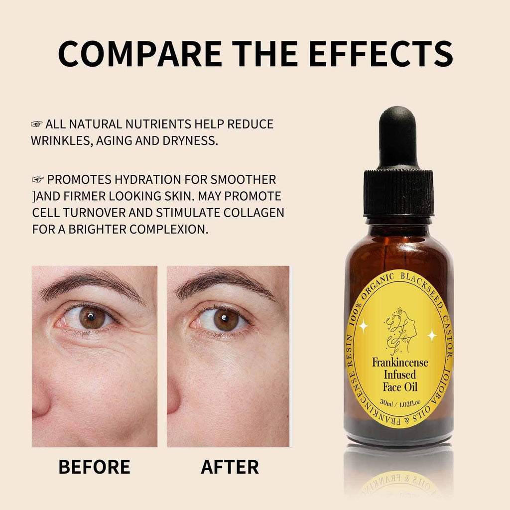 Frankincense Resin Oil Facial Serum 3PC P439